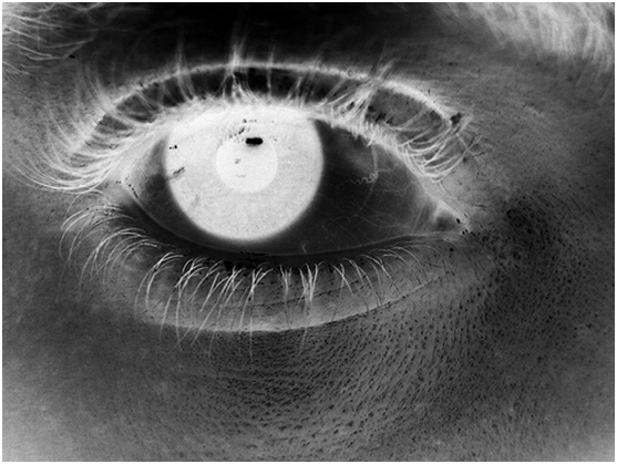 eye